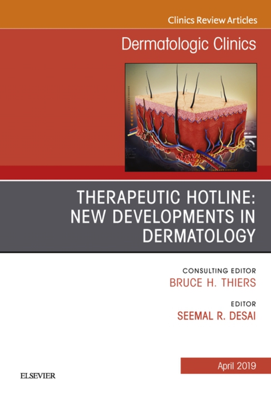 Therapeutic Hotline: New Developments in Dermatology, An Issue of Dermatologic Clinics (e-bog) af Desai, Seemal R