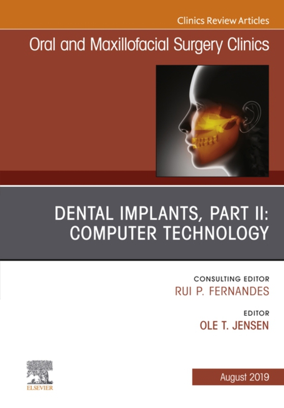 Dental Implants, Part II: Computer Technology, An Issue of Oral and Maxillofacial Surgery Clinics of North America (e-bog) af Jensen, Ole