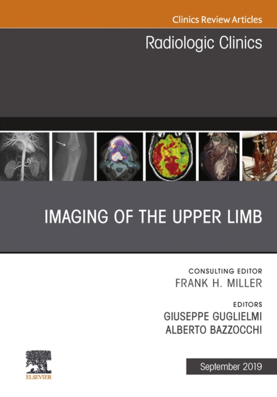 Imaging of the Upper Limb, An Issue of Radiologic Clinics of North America (e-bog) af Bazzocchi, Alberto