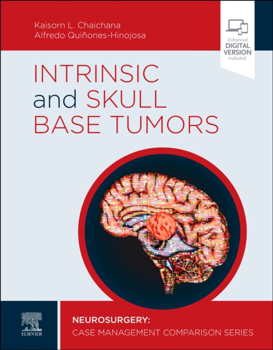 Intrinsic and Skull Base Tumors - E-Book (e-bog) af -