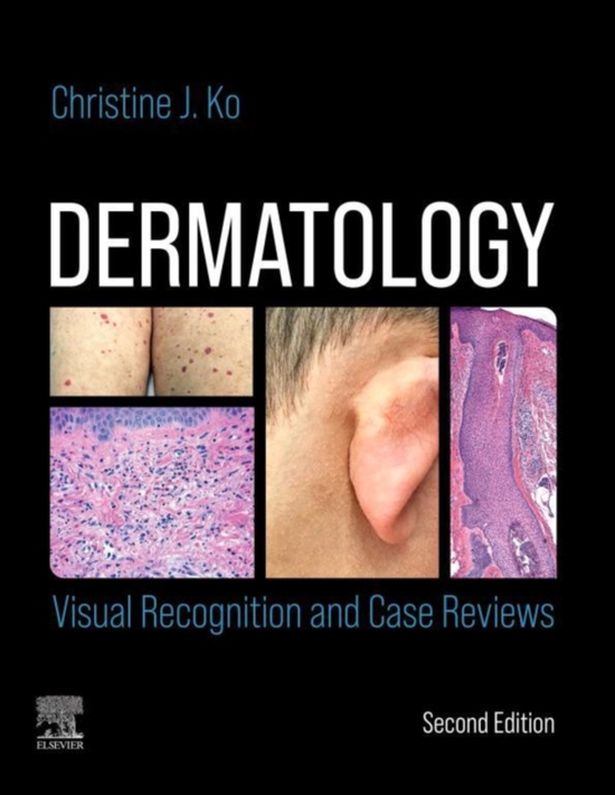 Dermatology: Visual Recognition and Case Reviews E-Book (e-bog) af Ko, Christine