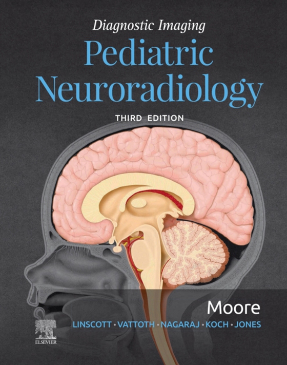 Diagnostic Imaging: Pediatric Neuroradiology E-Book