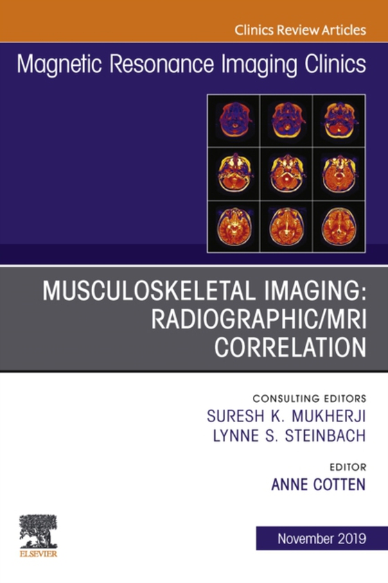 Musculoskeletal Imaging: Radiographic/MRI Correlation, An Issue of Magnetic Resonance Imaging Clinics of North America (e-bog) af Cotten, Anne