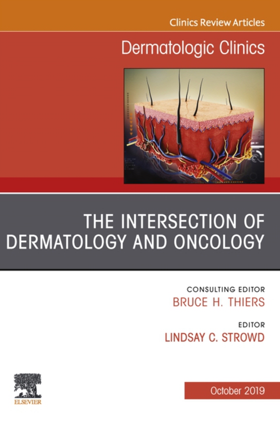 Intersection of Dermatology and Oncology, An Issue of Dermatologic Clinics (e-bog) af Strowd, Lindsay C.