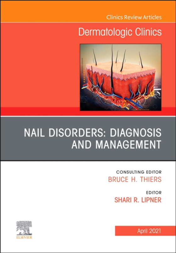 Nail Disorders: Diagnosis and Management, An Issue of Dermatologic Clinics (e-bog) af -