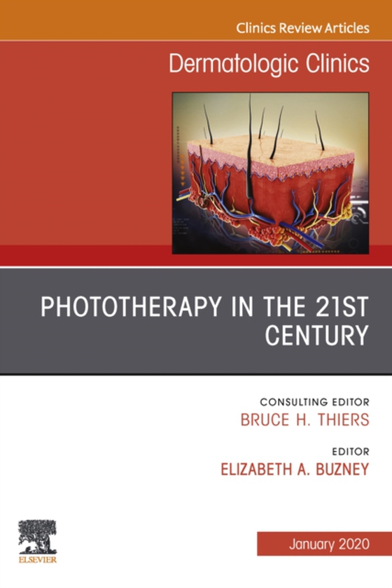 Phototherapy,An Issue of Dermatologic Clinics E-Book (e-bog) af -