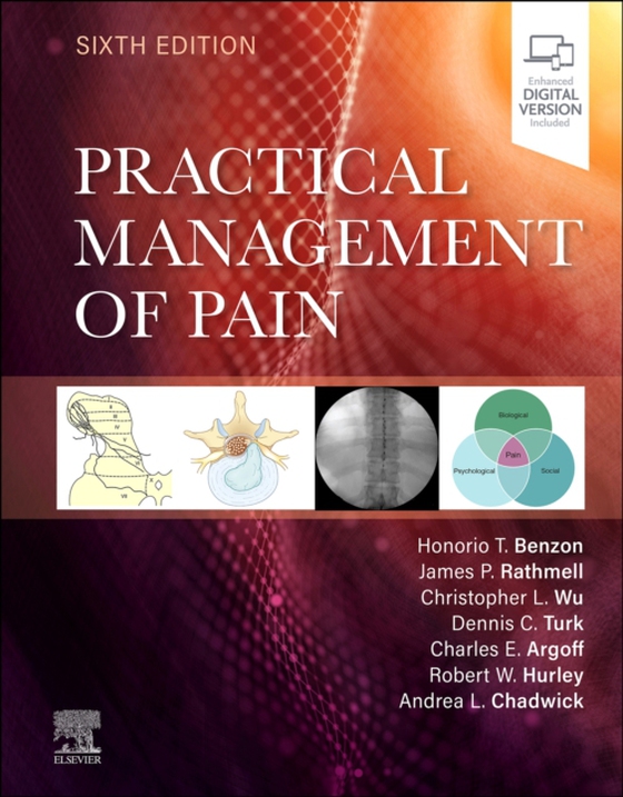 Practical Management of Pain E-Book (e-bog) af Hurley, Robert W