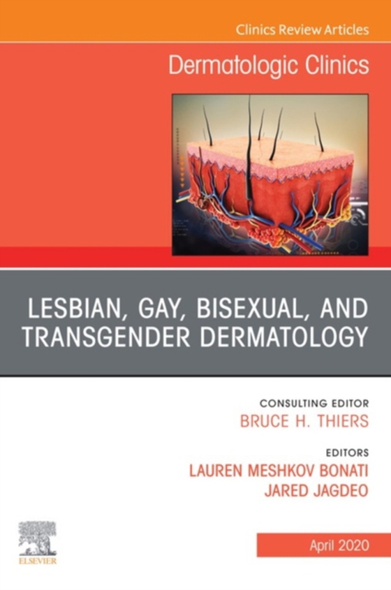 Transgender Dermatology,An Issue of Dermatologic Clinics (e-bog) af -