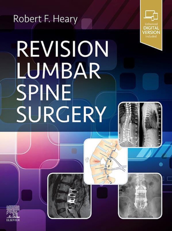 Revision Lumbar Spine Surgery E-Book (e-bog) af -