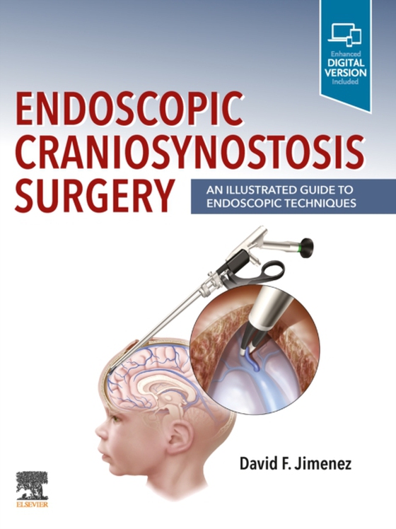 Endoscopic Craniosynostosis Surgery E-Book (e-bog) af -