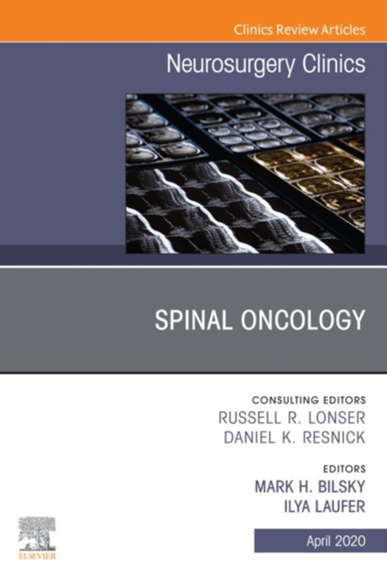 Spinal Oncology An Issue of Neurosurgery Clinics of North America (e-bog) af -