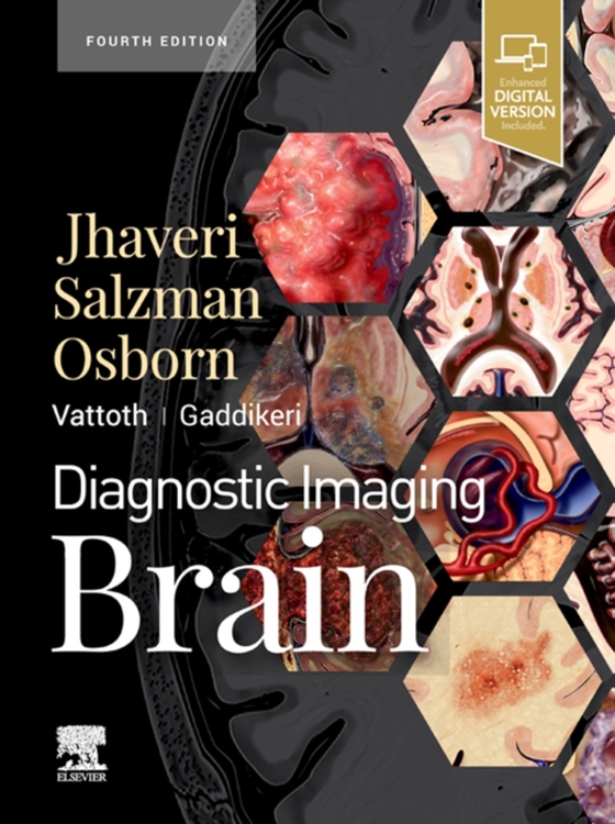 Diagnostic Imaging: Brain E-Book (e-bog) af Jhaveri, Miral D.