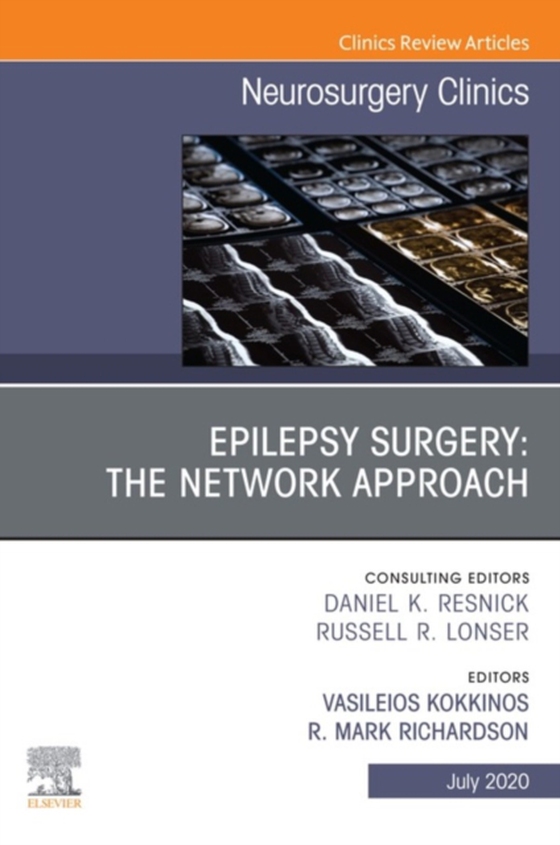 Epilepsy Surgery: The Network Approach, An Issue of Neurosurgery Clinics of North America, E-Book (e-bog) af -