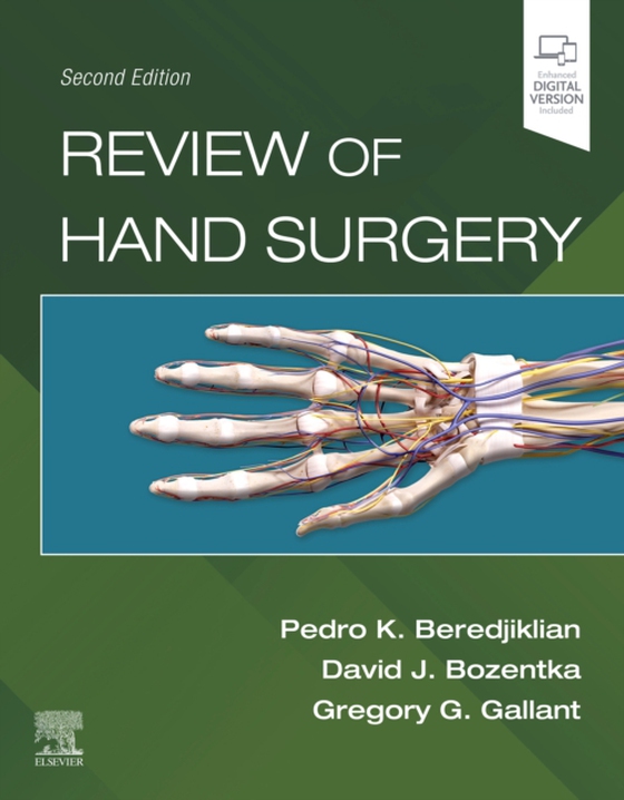 Review of Hand Surgery, E-Book (e-bog) af -