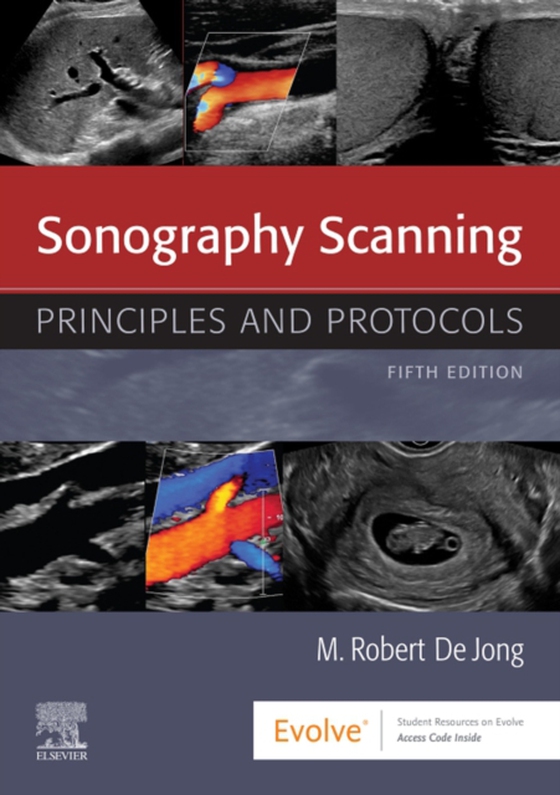 Sonography Scanning E-Book (e-bog) af deJong, M. Robert