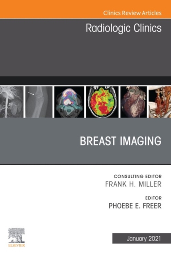 Breast Imaging, An Issue of Radiologic Clinics of North America, E-Book