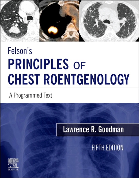 Felson's Principles of Chest Roentgenology E-Book (e-bog) af Goodman, Lawrence R.