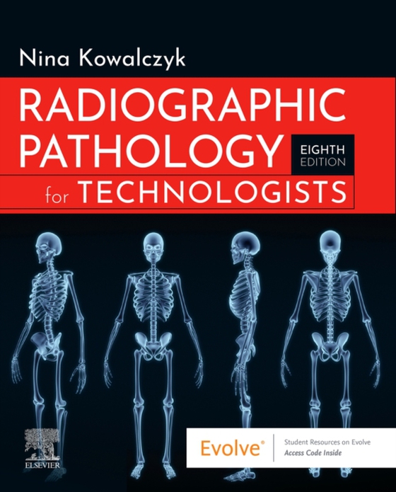 Radiographic Pathology for Technologists, E-Book (e-bog) af Kowalczyk, Nina