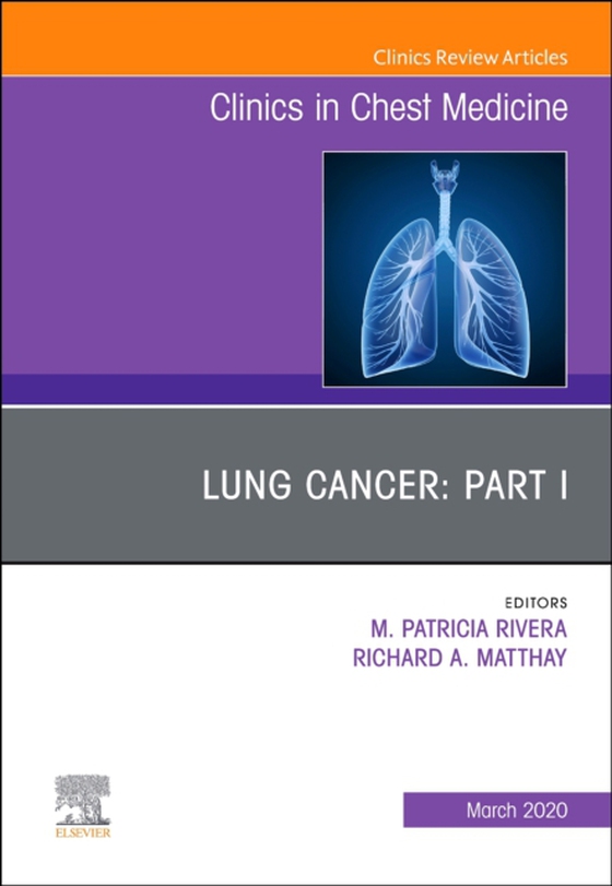 Lung Cancer, Part I, An Issue of Clinics in Chest Medicine (e-bog) af -