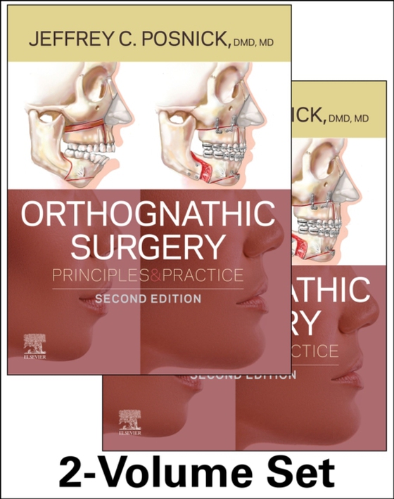 Orthognathic Surgery E-Book