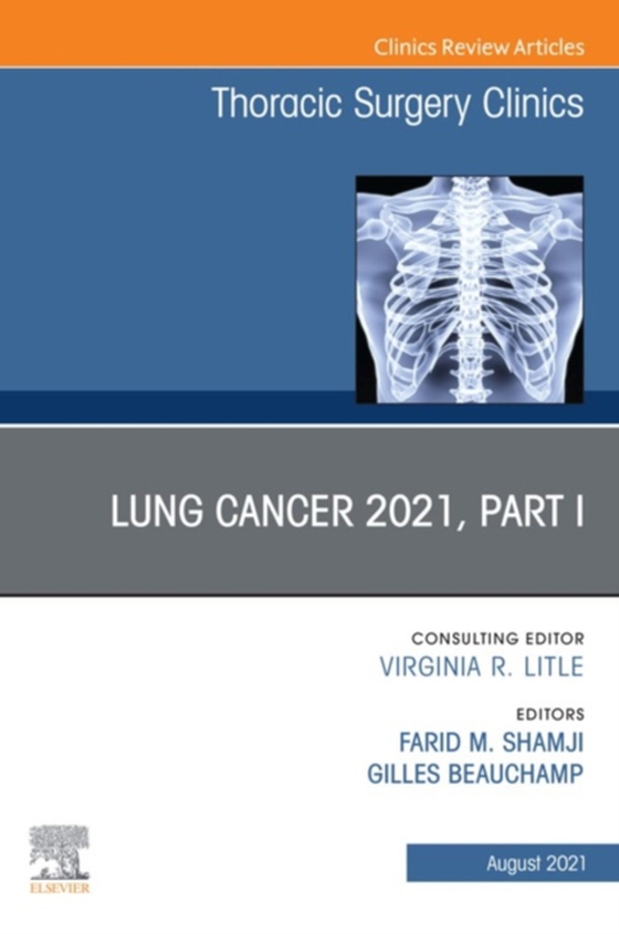 Lung Cancer 2021, Part 1, An Issue of Thoracic Surgery Clinics,E-Book