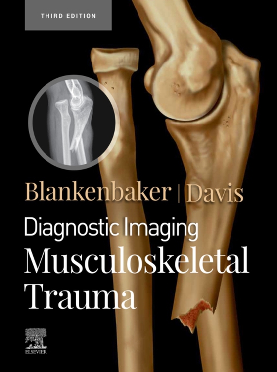 Diagnostic Imaging: Musculoskeletal Trauma,E-Book (e-bog) af Davis, Kirkland W.