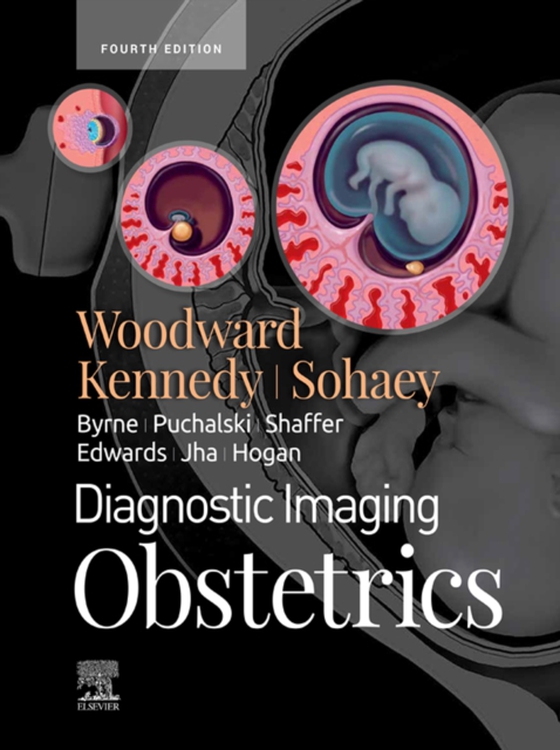 Diagnostic Imaging: Obstetrics E-Book (e-bog) af Woodward, Paula J.