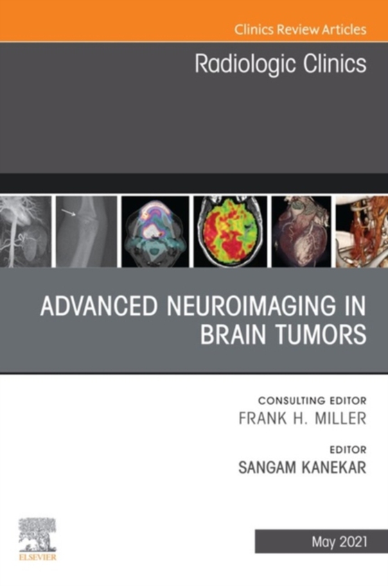 Advanced Neuroimaging in Brain Tumors, An Issue of Radiologic Clinics of North America, E-Book (e-bog) af -