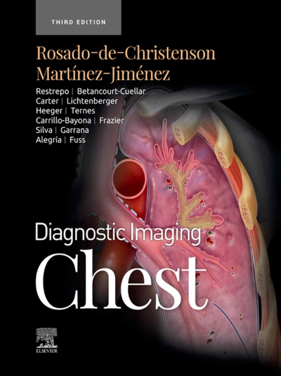 Diagnostic Imaging: Chest - E-Book