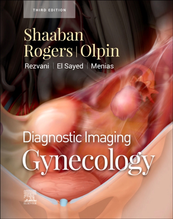 Diagnostic Imaging: Gynecology - E-Book (e-bog) af Rogers, Douglas