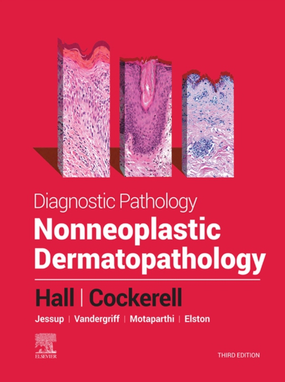 Diagnostic Pathology: Nonneoplastic Dermatopathology - E-Book (e-bog) af Hall, Brian J.