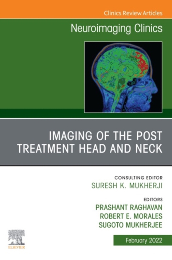 Imaging of the Post Treatment Head and Neck, An Issue of Neuroimaging Clinics of North America, E-Book (e-bog) af -