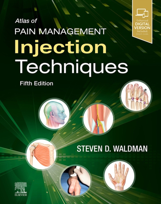 Atlas of Pain Management Injection Techniques - E-Book (e-bog) af Waldman, Steven D.