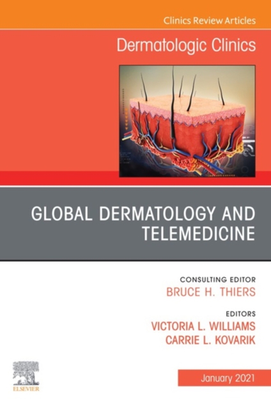 Global Dermatology and Telemedicine, An Issue of Dermatologic Clinics , E-Book (e-bog) af -