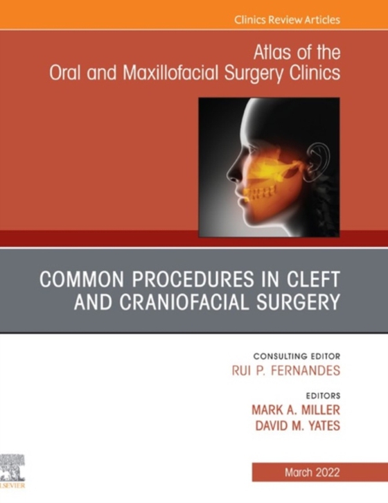 Cleft and Craniofacial Surgery, An Issue of Atlas of the Oral & Maxillofacial Surgery Clinics, E-Book (e-bog) af -