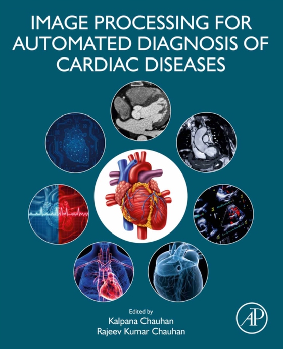 Image Processing for Automated Diagnosis of Cardiac Diseases (e-bog) af -