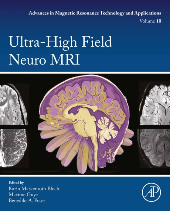 Ultra-High Field Neuro MRI (e-bog) af -