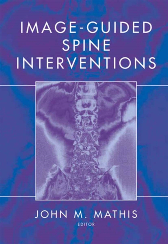 Image-Guided Spine Interventions (e-bog) af -