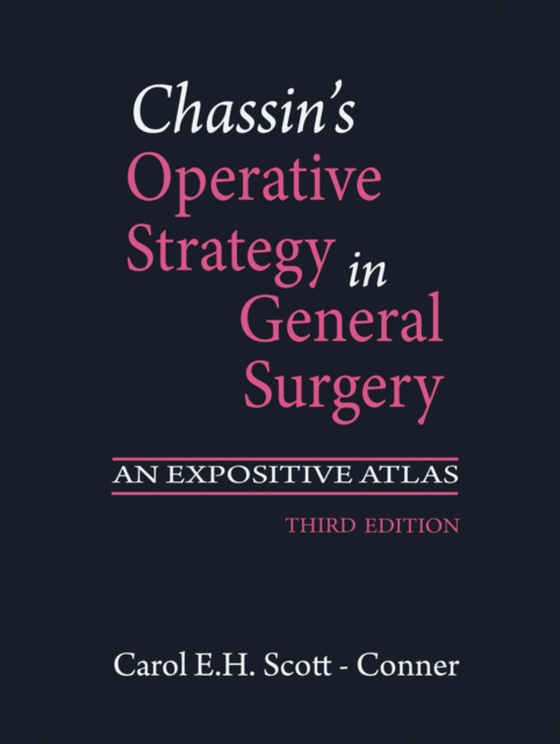 Chassin's Operative Strategy in General Surgery (e-bog) af -