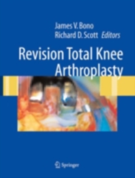 Revision Total Knee Arthroplasty (e-bog) af -
