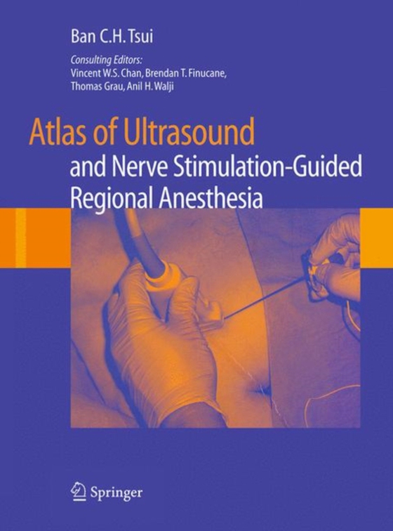 Atlas of Ultrasound- and Nerve Stimulation-Guided Regional Anesthesia (e-bog) af Tsui, Ban C.H.