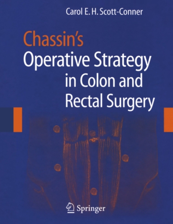 Chassin's Operative Strategy in Colon and Rectal Surgery (e-bog) af -