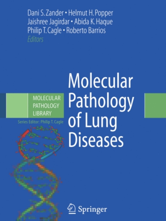 Molecular Pathology of Lung Diseases (e-bog) af -