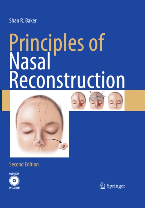 Principles of Nasal Reconstruction (e-bog) af Baker, Shan R.