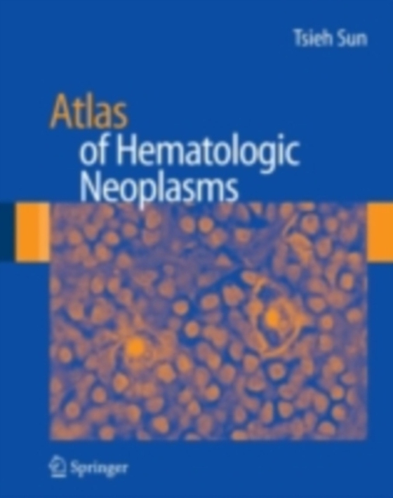 Atlas of Hematologic Neoplasms (e-bog) af Sun, Tsieh
