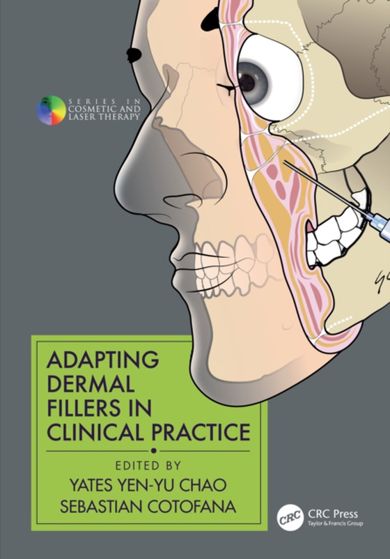 Adapting Dermal Fillers in Clinical Practice (e-bog) af -