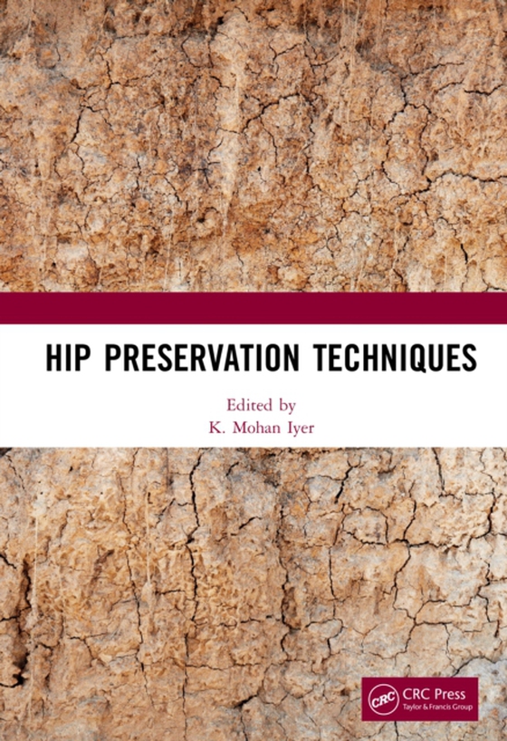 Hip Preservation Techniques (e-bog) af -