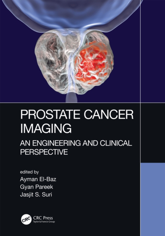 Prostate Cancer Imaging (e-bog) af -