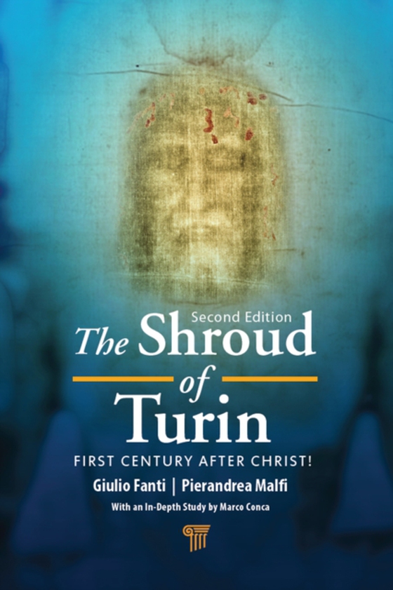 Shroud of Turin