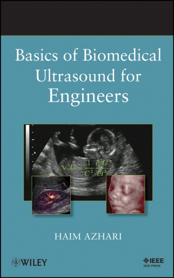 Basics of Biomedical Ultrasound for Engineers